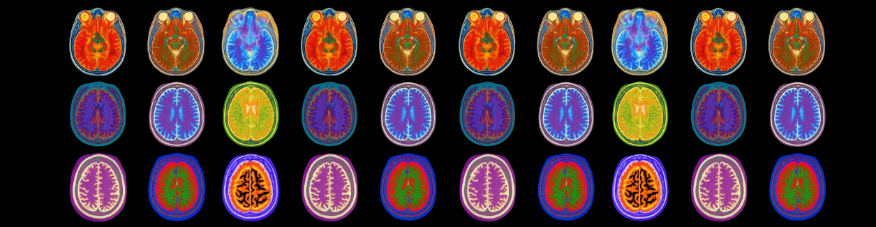 MozekGPT-inspirace-2025